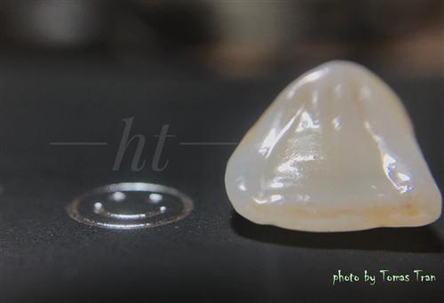 HT-Smile Zirconia - Confident with your smile